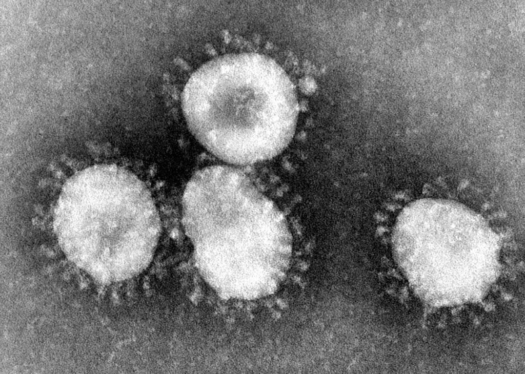 What is Coronaviruses